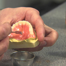 Confection de prothèse à Montréal - Bruno Del Papa (denturologiste à Montréal)